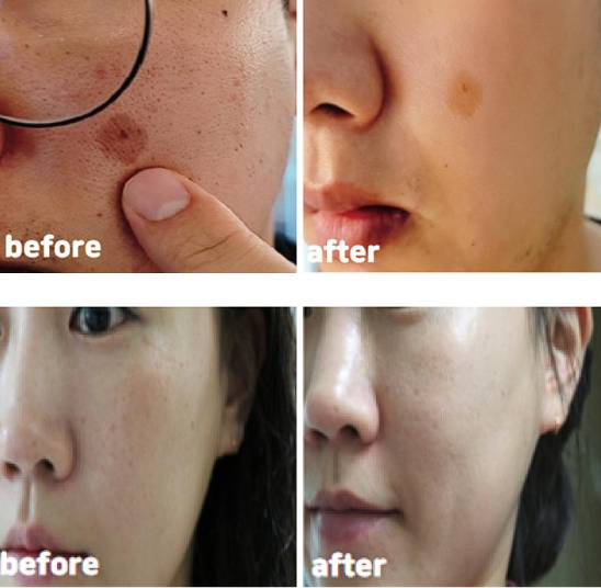 CellHappyCo Dark Spot Solution Cream 50g