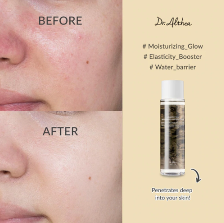 Dr. Althea Anastatica Skin Conditioning Toner