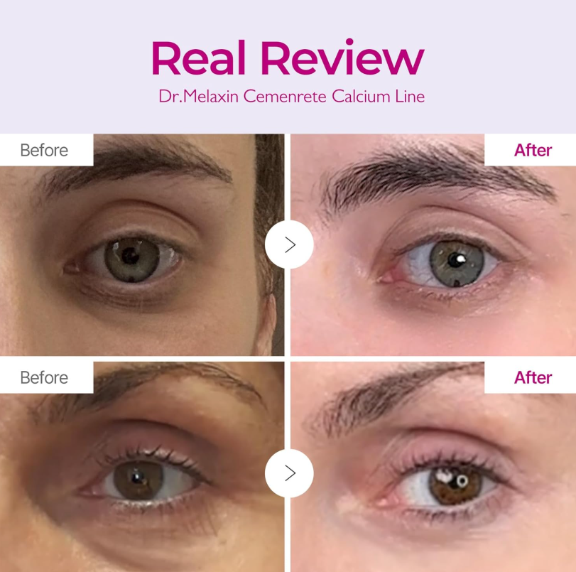 Dr. Melaxin Cemenrete Calcium Volume Cream 50ml