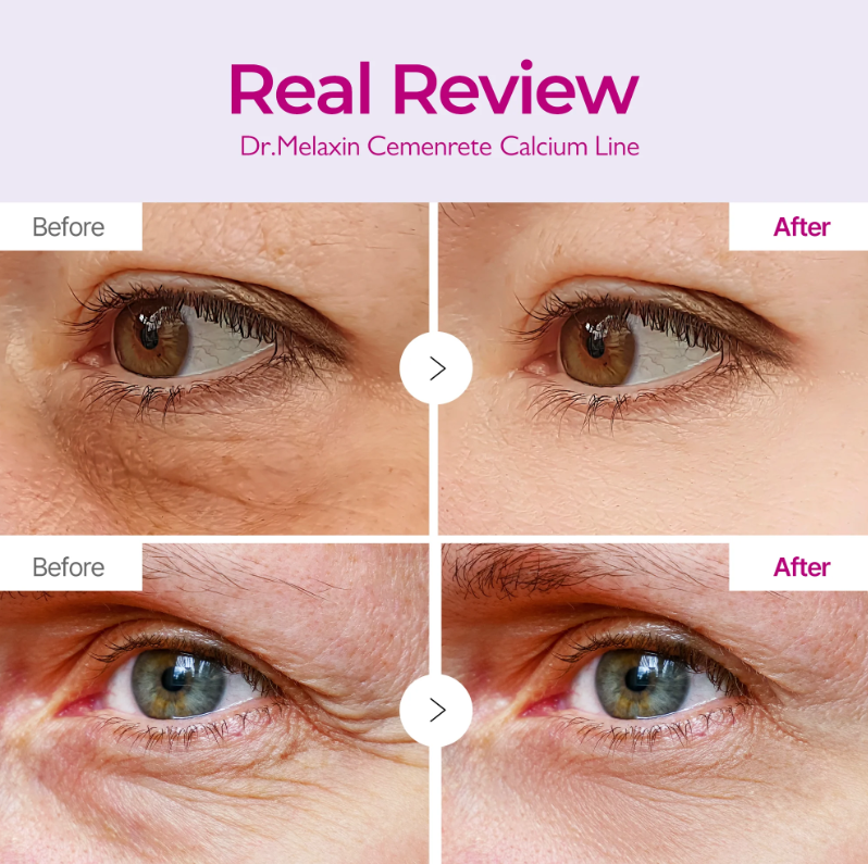 Dr. Melaxin Cemenrete Calcium Volume Multibalm 9g
