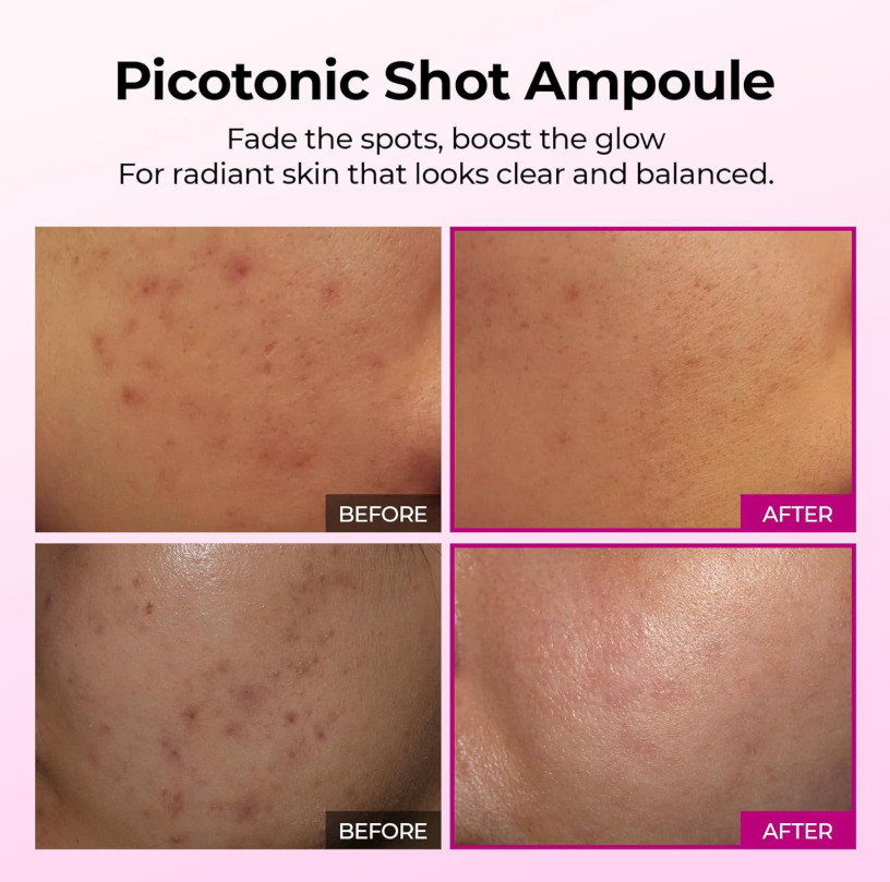 Dr. Melaxin Cemenrete Picotonic Shot Pigmentation Ampoule 30ml