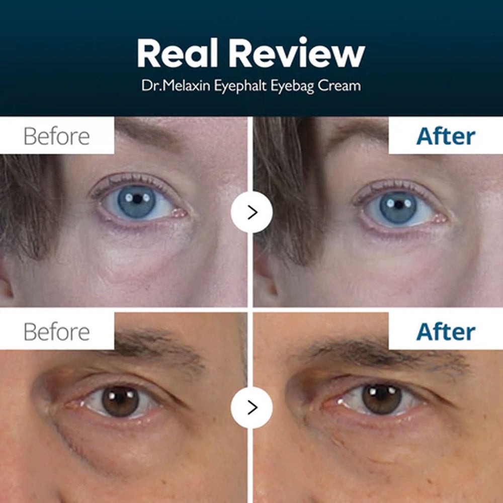 Dr. Melaxin Eyephalt Eyebag Cream 10ml