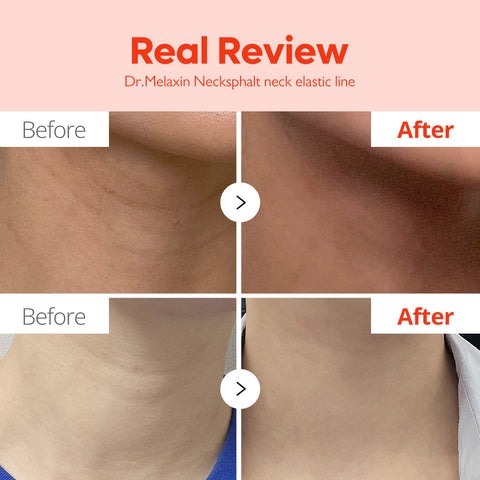 Dr. Melaxin Neck Sphaltecm Neck Barrier Cream 50ml