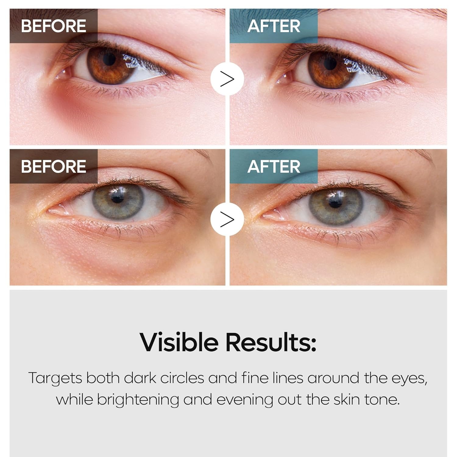 Dr. Melaxin Tx-Retinalsome Double Effect Eyecream 40g