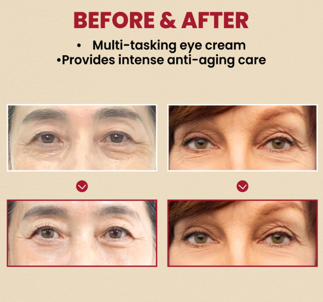Ksecret Seoul 1988 Eye Cream Retinal Liposome 4% + Fermented Bean