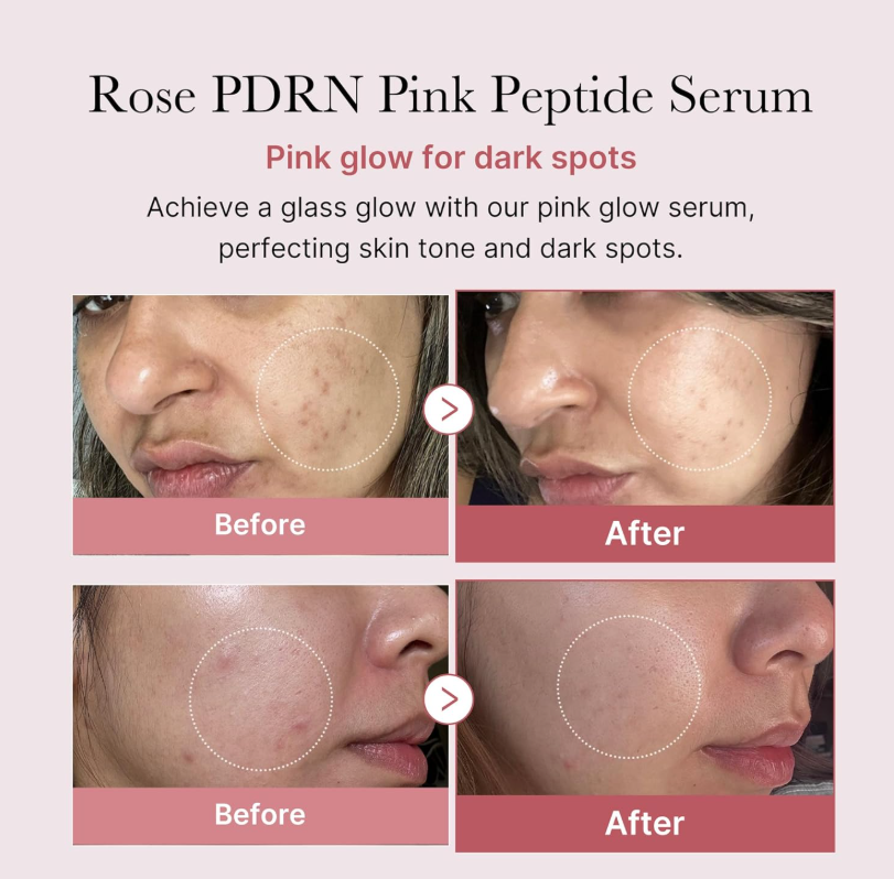 Medicube PDRN Pink Peptide Serum 30ml