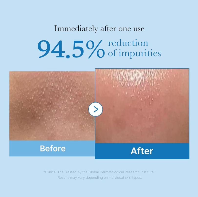 Medicube Zero Pore Blackhead Deep Cleansing Oil 205ml